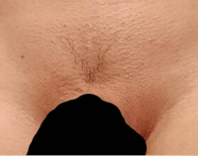 Imtimfrisur V